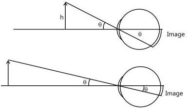A simple microscope (magnifier): a convex lens of short focal length forms a magnified virtual image of a small object placed within the focus.